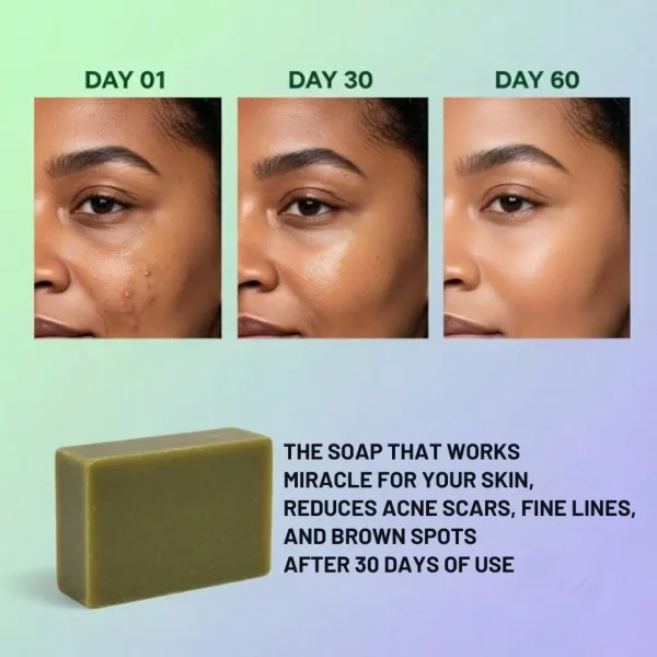 Bitter Miracle Soap Bar after 30 days of using